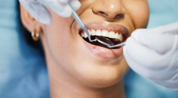 Best Emergency Pediatric Dental Care in Fairchild Af, WA