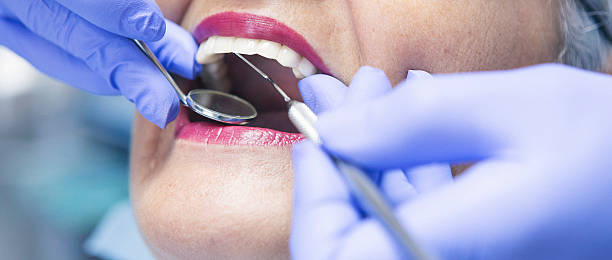 Best Emergency Care for Gum Disease in Fairchild Af, WA